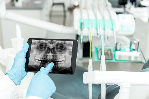 What-is-dental-technology_ Achieve your best smile at Chandler Dentistry